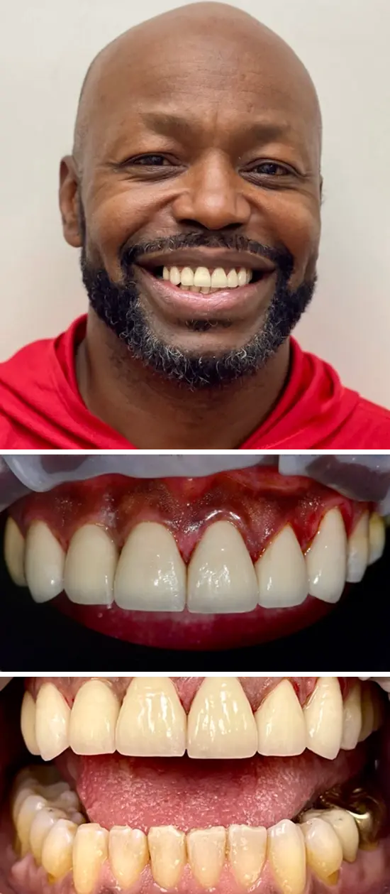 After cosmetic dental treatment showing the patient's restored and enhanced smile.