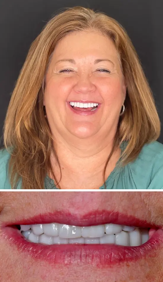 After cosmetic dental treatment showing the patient's restored and enhanced smile.