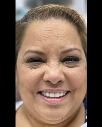 Jessica smiles confidently after her dental treatment at our Plantation practice.