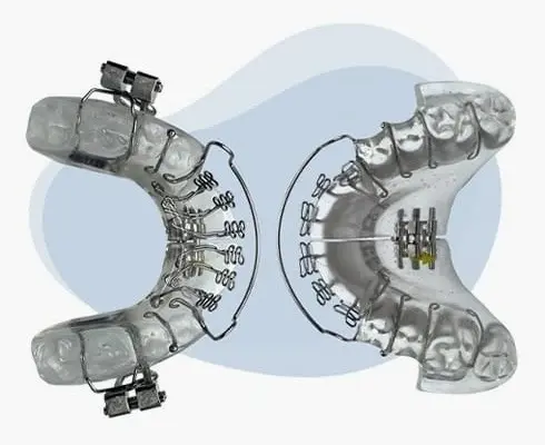 Airway expansion appliance shown from front and back views with dental measurements and components.
